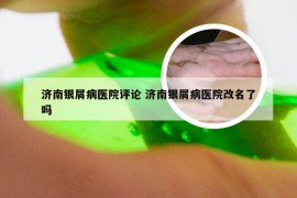 济南银屑病医院评论 济南银屑病医院改名了吗