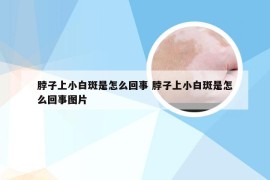 脖子上小白斑是怎么回事 脖子上小白斑是怎么回事图片