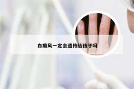 白癜风一定会遗传给孩子吗