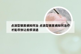 点滴型银屑病如何治 点滴型银屑病如何治疗才能尽快让皮疹消退