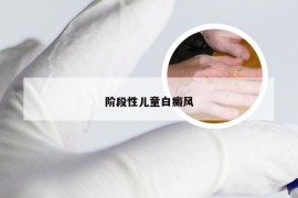 阶段性儿童白癜风