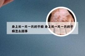 身上长一片一片的干癣 身上长一片一片的干癣怎么回事