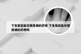 下支架后能吃银屑病的药吧 下支架后能吃银屑病的药吧吗