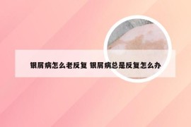 银屑病怎么老反复 银屑病总是反复怎么办