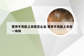 营养不良脸上白斑怎么治 营养不良脸上白色一块块