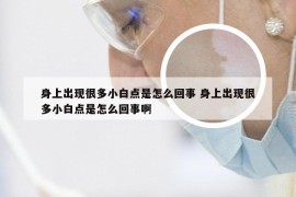 身上出现很多小白点是怎么回事 身上出现很多小白点是怎么回事啊