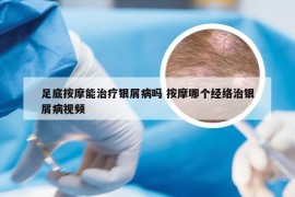 足底按摩能治疗银屑病吗 按摩哪个经络治银屑病视频