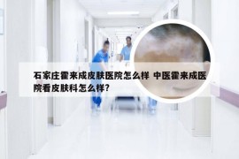 石家庄霍来成皮肤医院怎么样 中医霍来成医院看皮肤科怎么样?