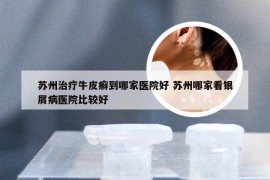 苏州治疗牛皮癣到哪家医院好 苏州哪家看银屑病医院比较好