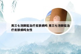 用三七泡脚能治疗皮肤病吗 用三七泡脚能治疗皮肤病吗女性