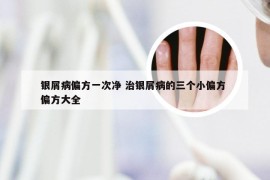 银屑病偏方一次净 治银屑病的三个小偏方 偏方大全