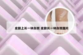 皮肤上长一块白斑 皮肤长一块白斑图片