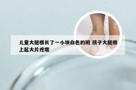 儿童大腿根长了一小块白色的班 孩子大腿根上起大片疙瘩