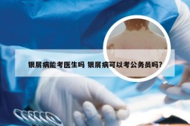 银屑病能考医生吗 银屑病可以考公务员吗?