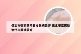 保定市哪家医院看皮肤病最好 保定哪家医院治疗皮肤病最好