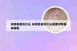 白斑患者吃什么 白斑患者吃什么蔬菜对恢复有帮助