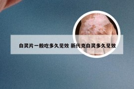 白灵片一般吃多久见效 新代克白灵多久见效