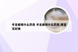 手足癣用什么药膏 手足癣用什么药膏,便宜又好用