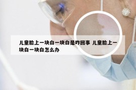 儿童脸上一块白一块白是咋回事 儿童脸上一块白一块白怎么办