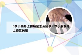 6岁小孩身上像癣是怎么回事 6岁小朋友身上经常长坨