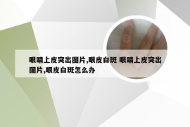 眼睛上皮突出图片,眼皮白斑 眼睛上皮突出图片,眼皮白斑怎么办