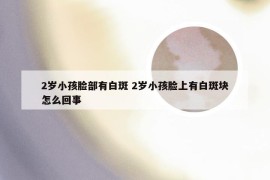 2岁小孩脸部有白斑 2岁小孩脸上有白斑块怎么回事