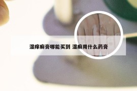 湿痒癣膏哪能买到 湿癣用什么药膏