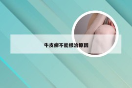 牛皮癣不能根治原因