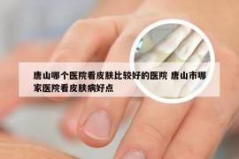 唐山哪个医院看皮肤比较好的医院 唐山市哪家医院看皮肤病好点