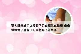 婴儿湿疹好了之后留下的白斑怎么处理 宝宝湿疹好了后留下的白色印子怎么办