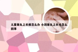 儿童睾丸上长癣怎么办 小孩睾丸上长毛怎么回事