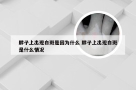 脖子上出现白斑是因为什么 脖子上出现白斑是什么情况