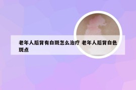 老年人后背有白斑怎么治疗 老年人后背白色斑点