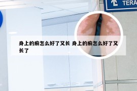 身上的癣怎么好了又长 身上的癣怎么好了又长了