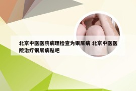 北京中医医院病理检查为银屑病 北京中医医院治疗银屑病贴吧