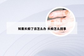 如果长癣了该怎么办 长癣怎么回事