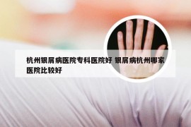 杭州银屑病医院专科医院好 银屑病杭州哪家医院比较好