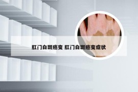 肛门白斑癌变 肛门白斑癌变症状