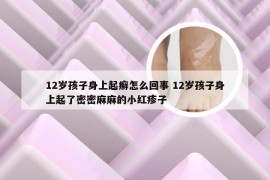 12岁孩子身上起癣怎么回事 12岁孩子身上起了密密麻麻的小红疹子