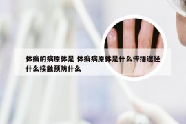 体癣的病原体是 体癣病原体是什么传播途径什么接触预防什么