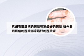 杭州看银屑病的医院哪家最好的医院 杭州看银屑病的医院哪家最好的医院呢