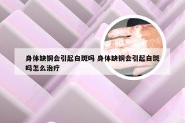 身体缺铜会引起白斑吗 身体缺铜会引起白斑吗怎么治疗