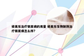 修美乐治疗银屑病的用量 修美乐生物制剂治疗银屑病怎么样?