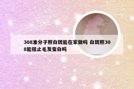 308准分子照白斑能在家做吗 白斑照308能阻止毛发变白吗