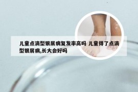 儿童点滴型银屑病复发率高吗 儿童得了点滴型银屑病,长大会好吗