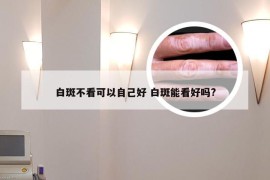 白斑不看可以自己好 白斑能看好吗?