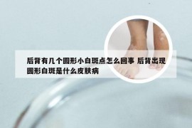 后背有几个圆形小白斑点怎么回事 后背出现圆形白斑是什么皮肤病