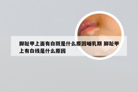 脚趾甲上面有白斑是什么原因哺乳期 脚趾甲上有白线是什么原因