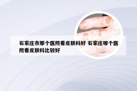 石家庄市那个医院看皮肤科好 石家庄哪个医院看皮肤科比较好