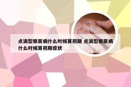 点滴型银屑病什么时候算初期 点滴型银屑病什么时候算初期症状